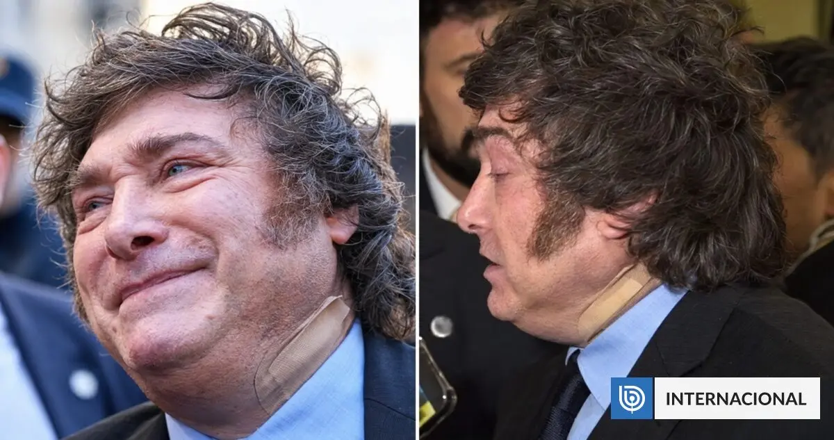 Imagen del artículo